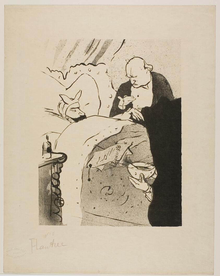 Carnot is Sick! — Henri de Toulouse-Lautrec