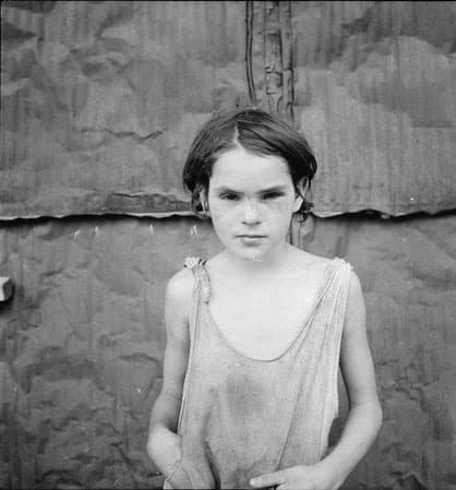 Damaged Child, Shacktown, Elm Grove, Oklahoma — Dorothea Lange