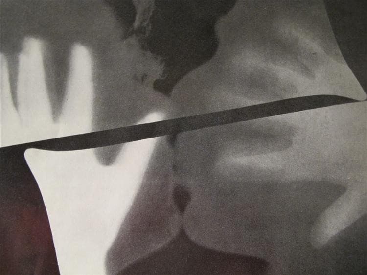 Rayograph (The Kiss) — Man Ray